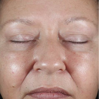 A close-up of a womans face with eyes closed, showing smooth, even-toned skin, minimal wrinkles, and natural texture, focusing on her forehead, nose, cheeks, and lips.