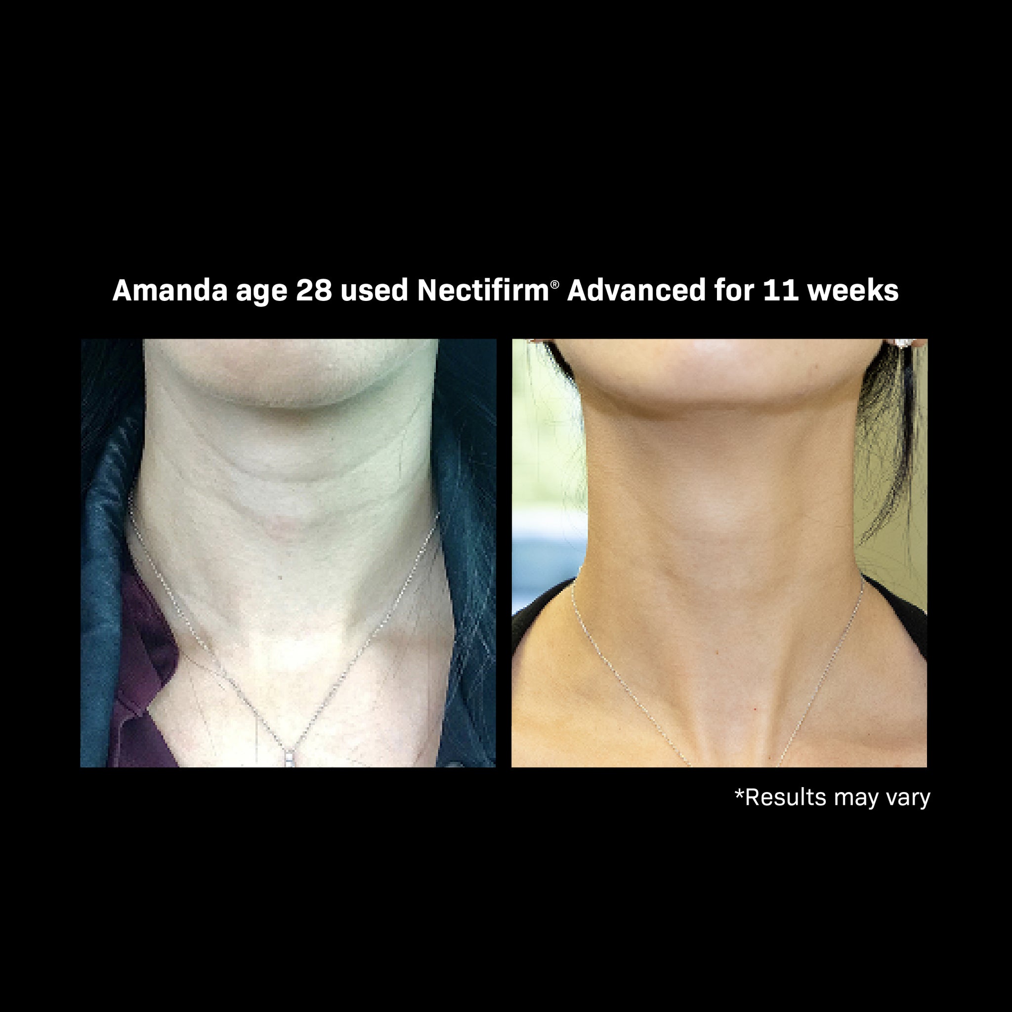 Nectifirm® ADVANCED