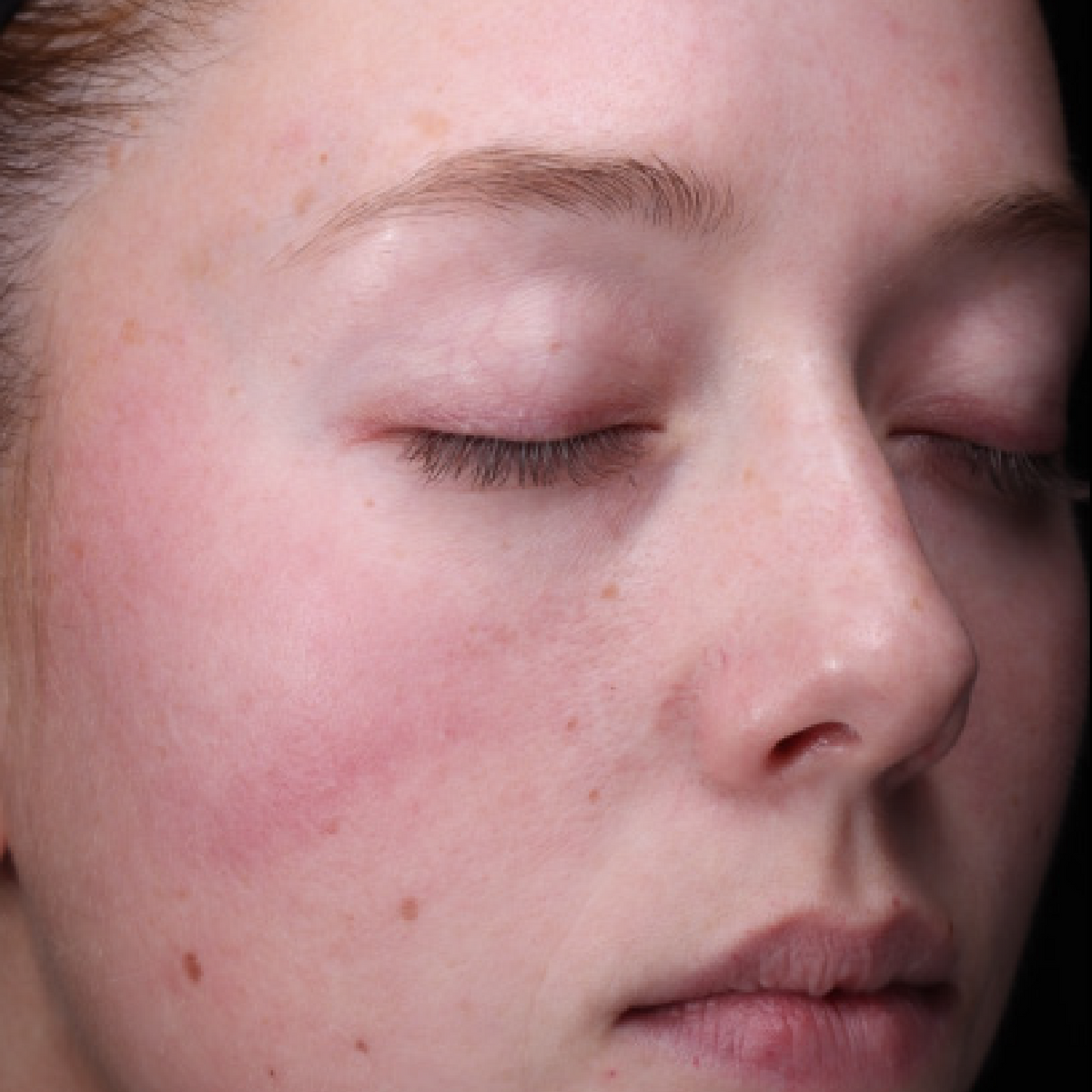 Radiance+ Resurfacing Serum | Revision Skincare®
