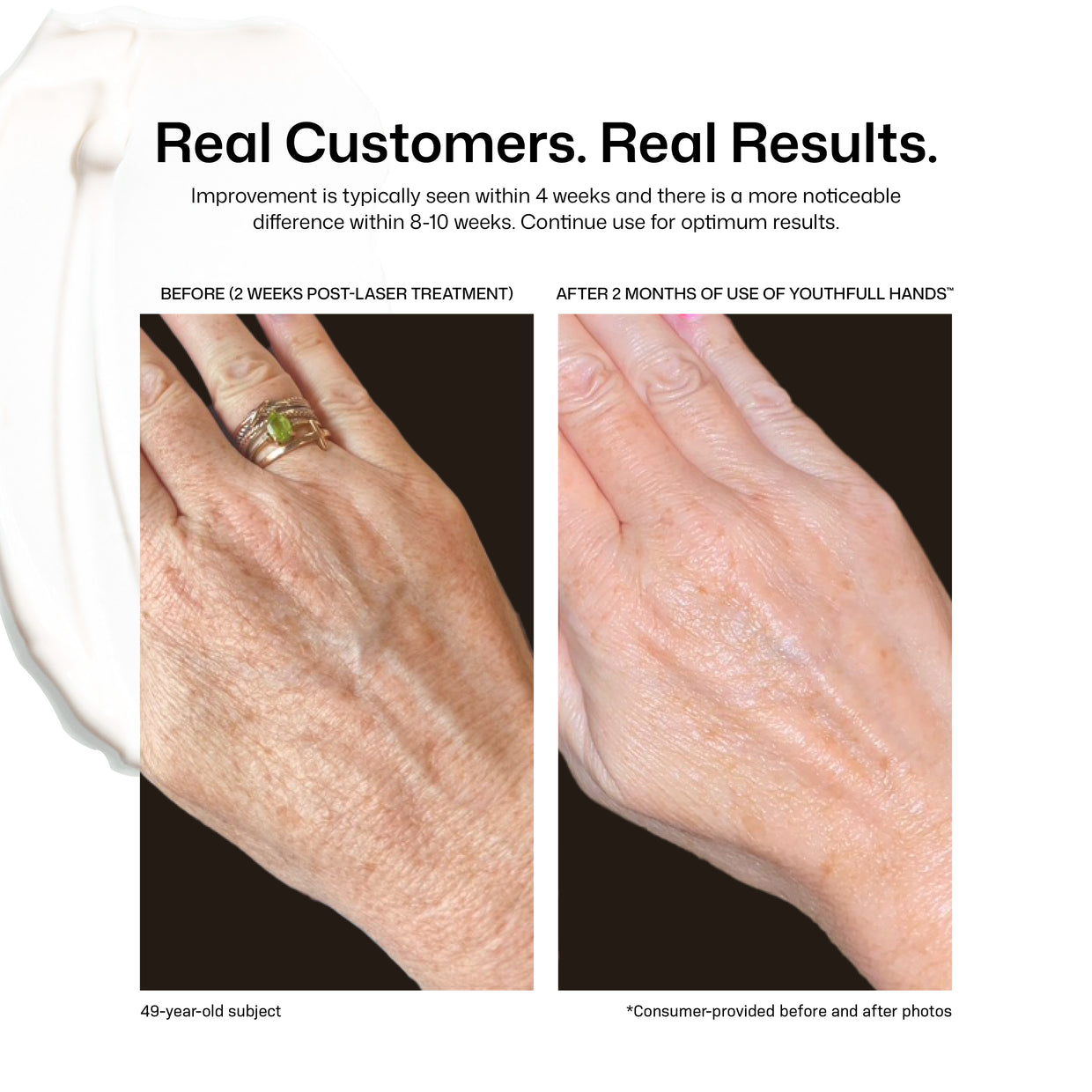 Side-by-side photos of a woman's hand: left shows wrinkles and age spots before, right shows smoother, more youthful skin after two months using YouthFull Hands™ by Revision Skincare.