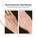 Side-by-side photos of a woman's hand: left shows wrinkles and age spots before, right shows smoother, more youthful skin after two months using YouthFull Hands™ by Revision Skincare.