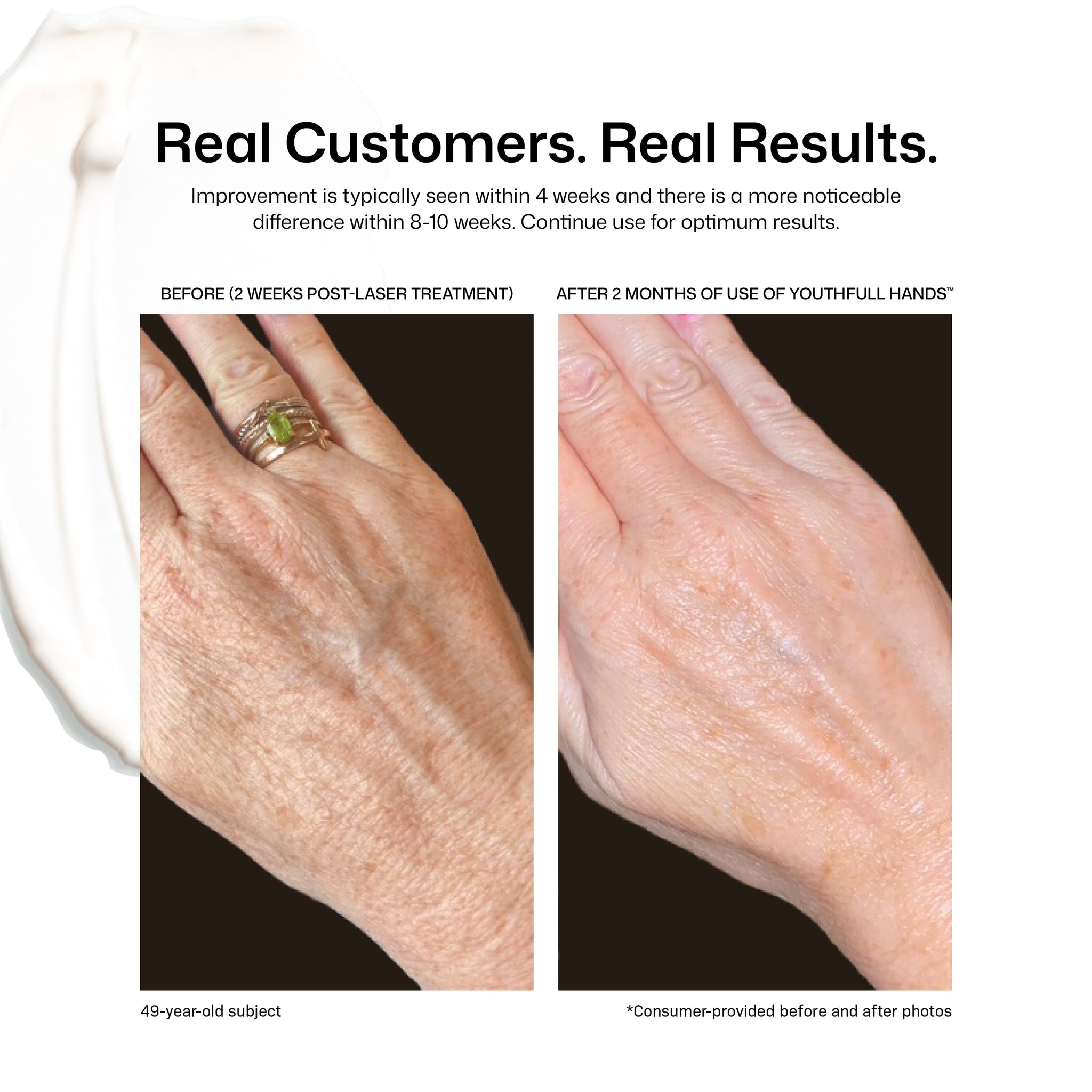 Side-by-side photos of a woman's hand: left shows wrinkles and age spots before, right shows smoother, more youthful skin after two months using YouthFull Hands™ by Revision Skincare.