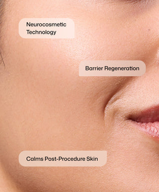 Close-up of a cheek with smooth, healthy skin and three text labels: Neurocosmetic Technology, Barrier Regeneration, Calms Post-Procedure Skin—highlighting Revision Skincare CMT Post-Procedure Cream® for epidermal barrier support and reduced downtime.