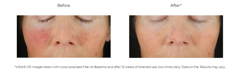 美容液 REVISION C+Correcthing30% 試してみた】C＋Correcting complex30% REVISION SKINCAREの効果