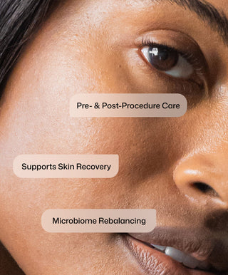 A close-up of a woman's clear, smooth skin highlights Revision Skincare's Procedure Prep & Recover Regimen with labels: Post-Procedure Skincare, Supports Skin Recovery, and Microbiome Rebalancing.