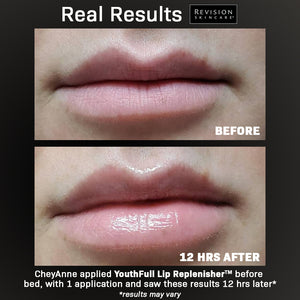 YouthFull Lip Replenisher® 0.33 oz