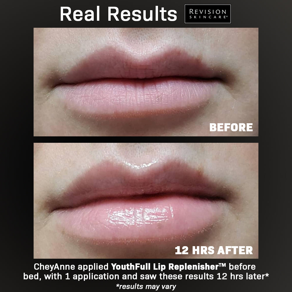 YouthFull Lip Replenisher™ -the definitive solution for youthful lips